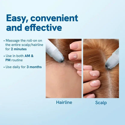 Rosemary Scalp Roll-On Serum – Redensyl & Anagain, 25ml