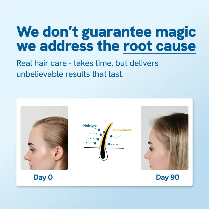 Rosemary Scalp Roll-On Serum – Redensyl & Anagain, 25ml