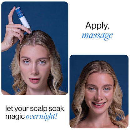 Rosemary Scalp Roll-On Serum – Redensyl & Anagain, 25ml